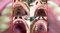 عکس / خالکوبی های وحشتناک سقف دهان / مرد تاتو کار با دهان مشتریان چه کرد ؟