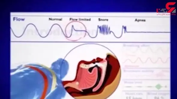 بحران جهانی چرت زدن مقامات سیاسی! + فیلم 