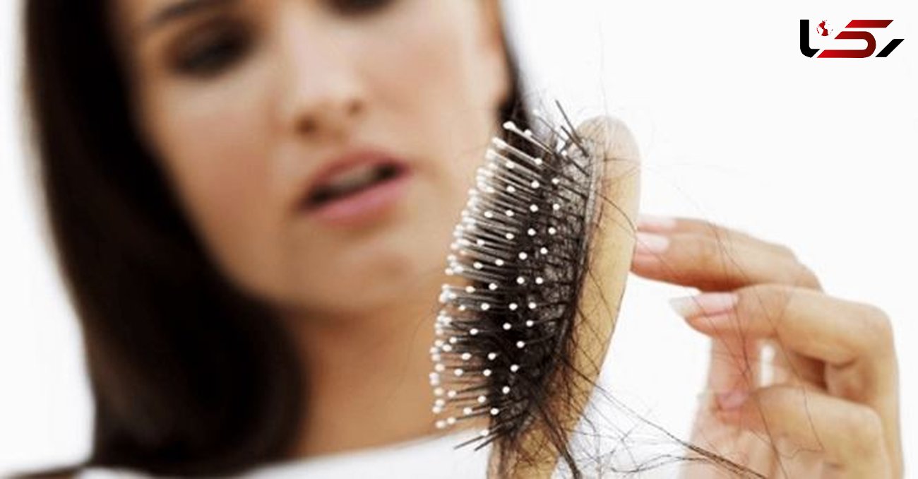 عوامل ریزش مو بعد از زایمان شناسایی شدند