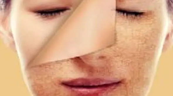 شادابی پوست با مرطوب کننده های طبیعی