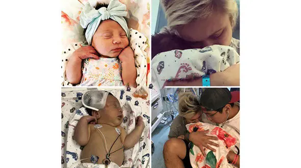 مرگ دردناک نوزاد دختر به خاطر یک بوسه+ عکس