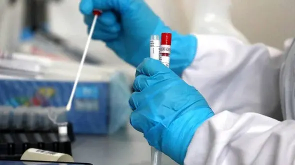 کدام بیمه ها تست PCR را تحت پوشش دارند؟