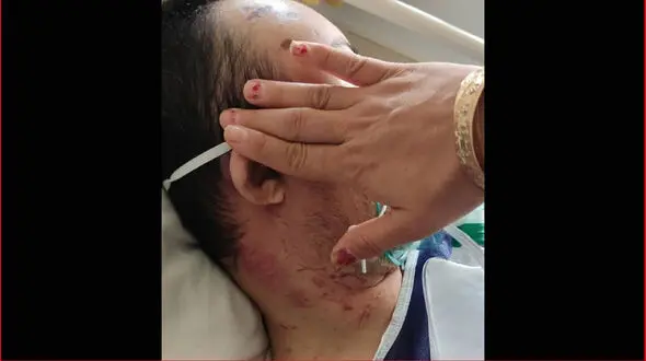 جزییات ضرب و شتم معلول ذهنی در مرکز نگهداری سمنان / واکنش نماینده گرمسار به پرونده تلخ + عکس