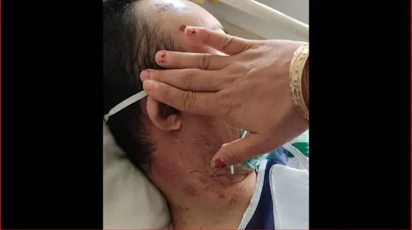 جزییات ضرب و شتم معلول ذهنی در مرکز نگهداری سمنان / واکنش نماینده گرمسار به پرونده تلخ + عکس