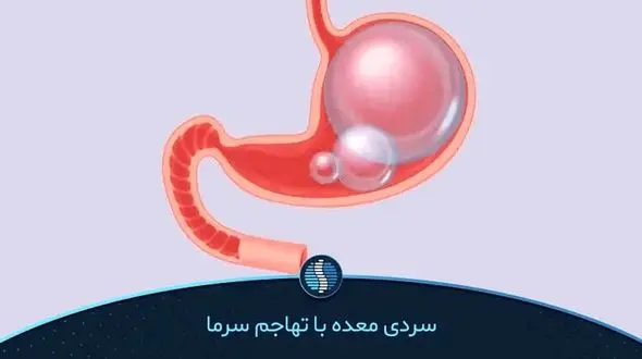 سردی معده: علل، علائم و راه‌ های درمان