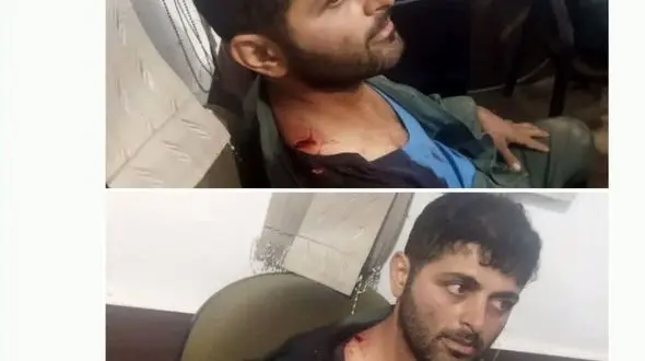 حمله شکارچیان غیرمجاز به محیط بان پارک ملی پابند نکا!