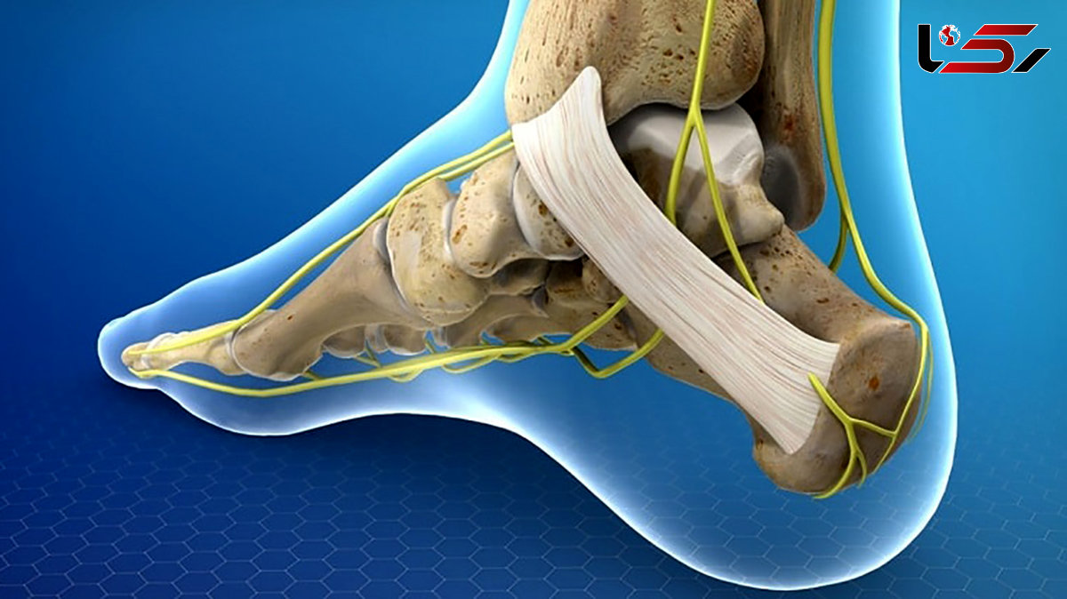 درد کف پا نشانه چیست؟