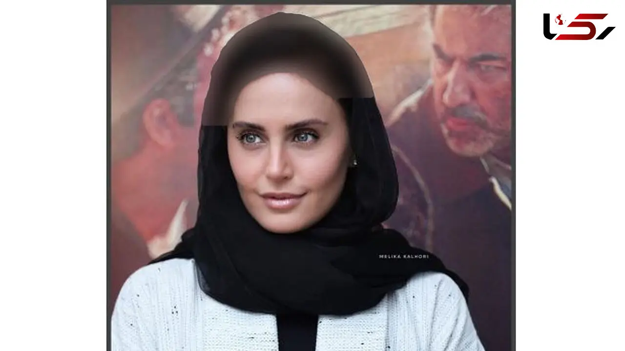 چهره جدید الناز شاکردوست / صفر تا صد تغییراتش + عکس ها