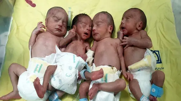 دومین چهارقلو‌های قزوین متولد شدند + عکس و جزییات