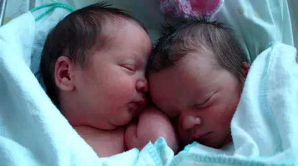 لحظه ای شگفت انگیز و بسیار نادر، به دنیا آوردن دوقلو در داخل پرده آمنیوتیک