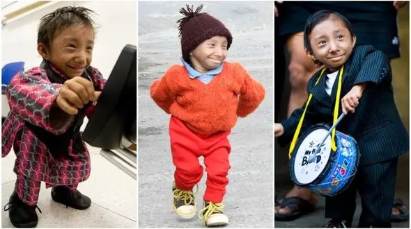 کوچکترین مرد جهان درگذشت + عکس