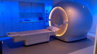 نصب و راه اندازی دستگاه MRI پیشرفته در بیمارستان کوهدشت