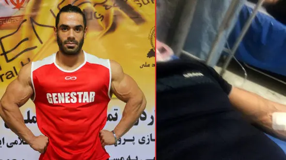 بیماری عجیب هرکول تهرانی، او را از مسابقات جهانی حذف کرد / بهزاد دیشب تا صبح در بیمارستان بود!