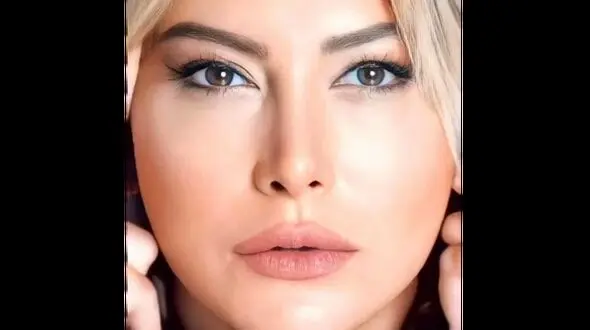 تغییر چهره حیرت انگیز بازیگران زن و مرد ایرانی ! / چه بودند و چه شدند؟!