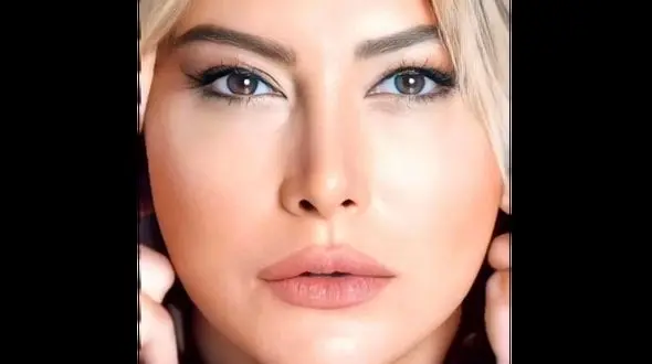 تغییر چهره حیرت انگیز بازیگران زن و مرد ایرانی ! / چه بودند و چه شدند؟!