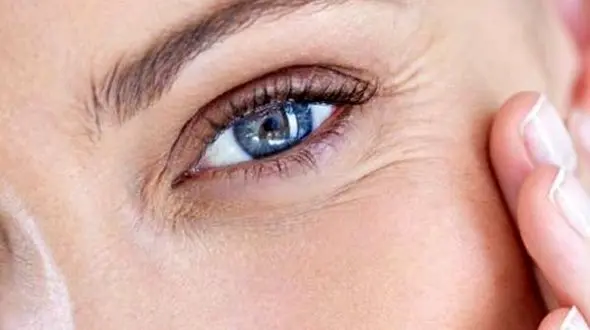 چروک دور چشم نشانه بیماری قلبی!