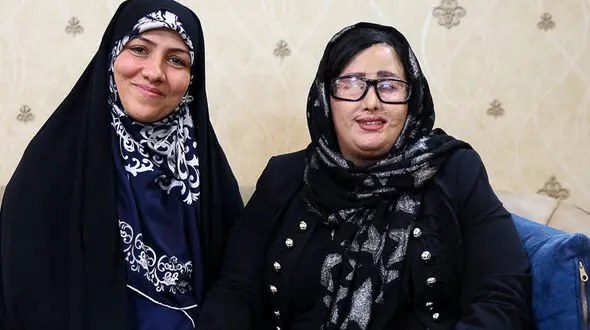 گزارش تصویری از دیدار نماینده زن مجلس با قربانی اسیدپاشی در اصفهان