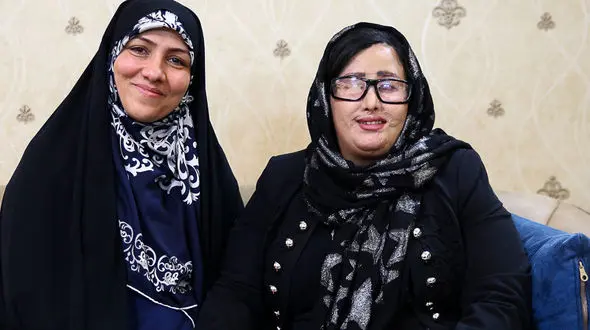 گزارش تصویری از دیدار نماینده زن مجلس با قربانی اسیدپاشی در اصفهان