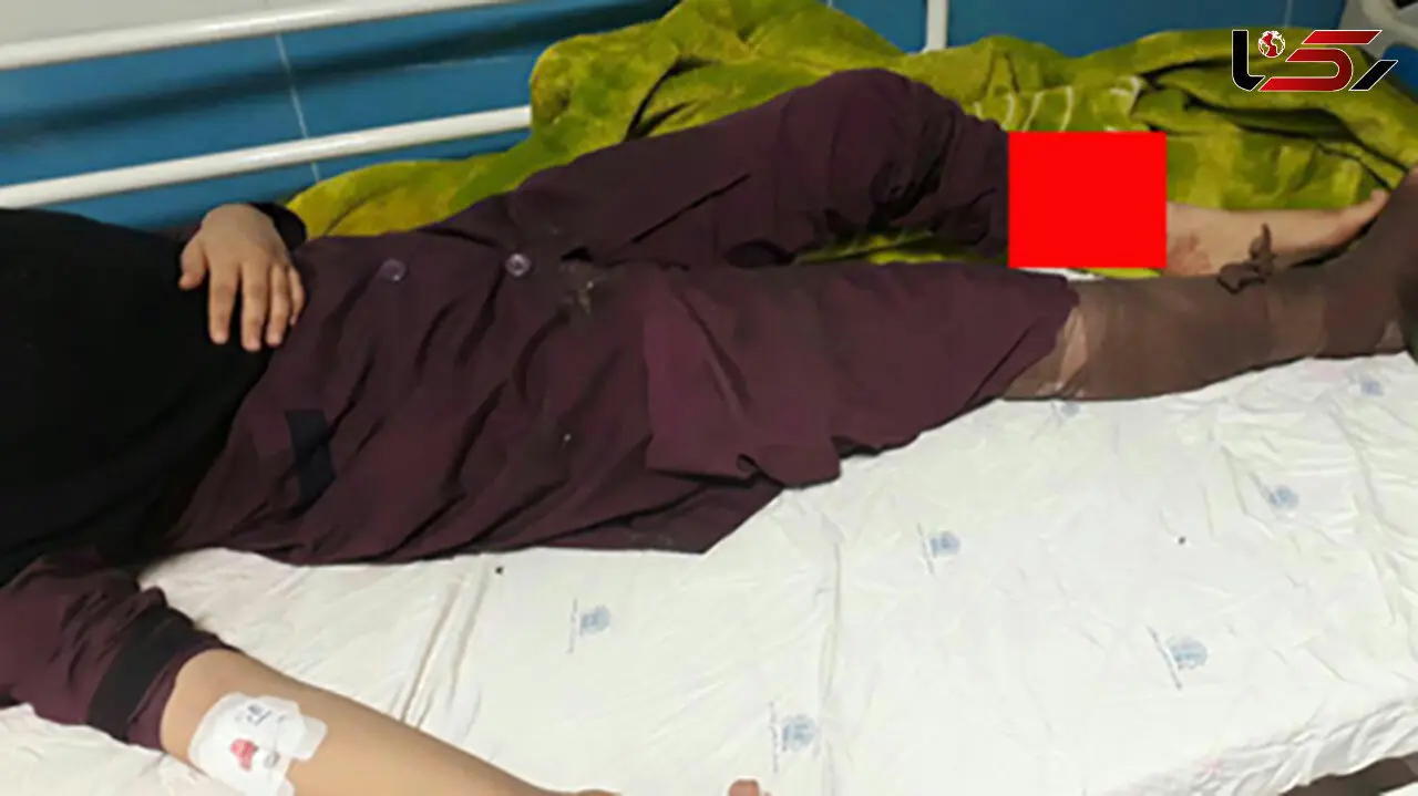 پشت پرده فاجعه در مدرسه دخترانه کوهدشت چه بود؟! / دختری که دیگر دست ندارد ! + عکس