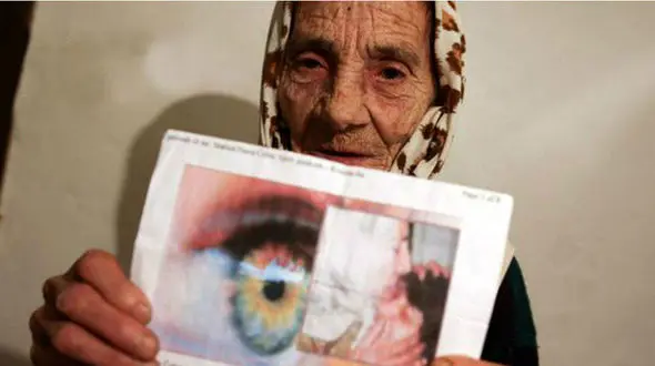 ننه حوا پیرزنی که با لیس زدن مردمک چشم بیماران را شفا می دهد+ تصاویر