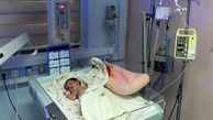  شکافته شدن سر نوزاد اصفهانی در  بیمارستان + عکس دلخراش