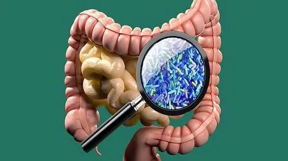 میکروبیوم های روده مادر در ابتلا کودک به اوتیسم نقش دارند