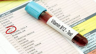 بارزترین نشانه های کمبود ویتامین B۱۲ 