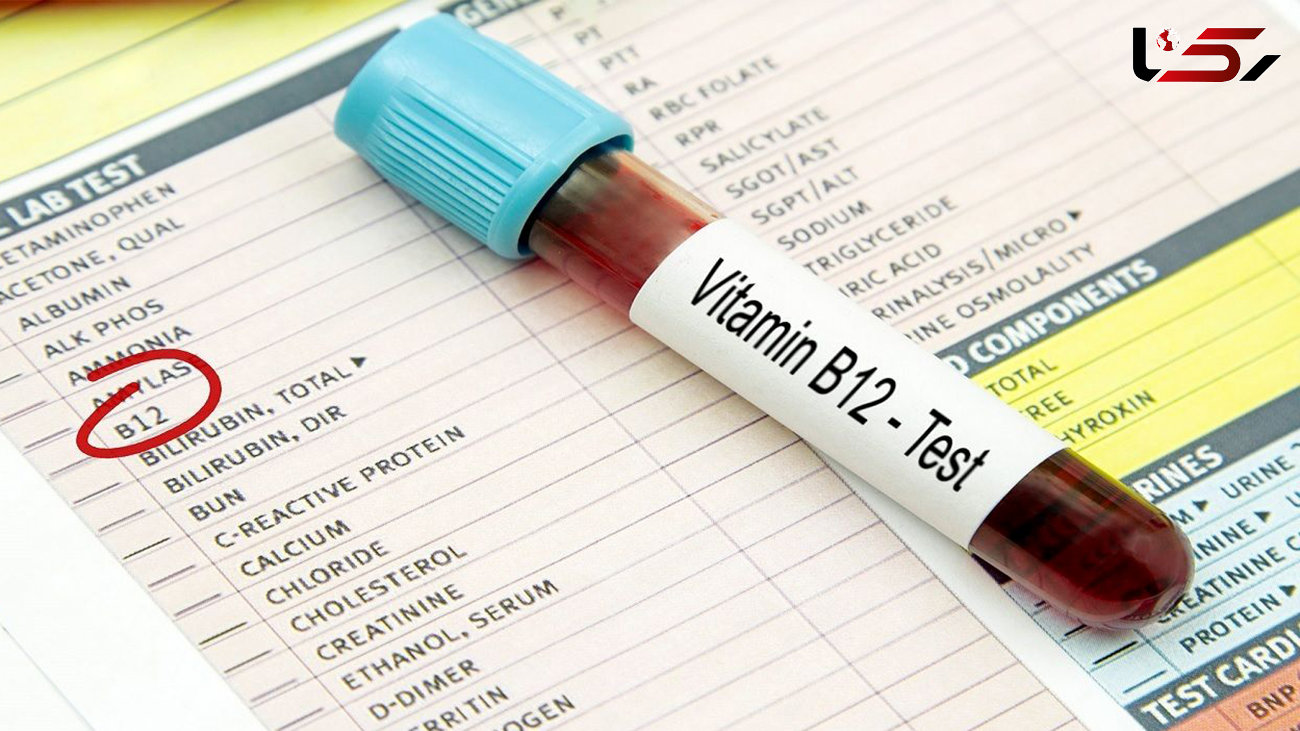 بارزترین نشانه های کمبود ویتامین B۱۲ 