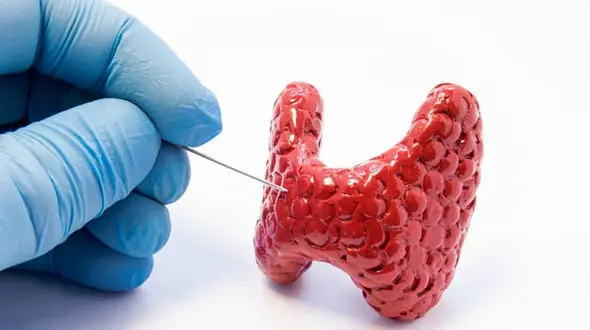 تیروئید پرکار خطرناک تر است یا تیروئید کم کار؟ / 10 علامت اختلال تیروئید