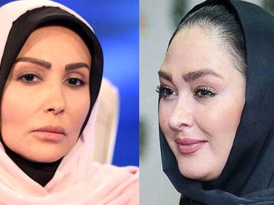 تغییر چهره اساسی از پرستو صالحی و الهام حمیدی / چی بودند چی شدند!؟