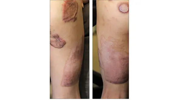  آزار هولناک نوید کوچولو توسط ناپدری اش در حمام +عکس 14+