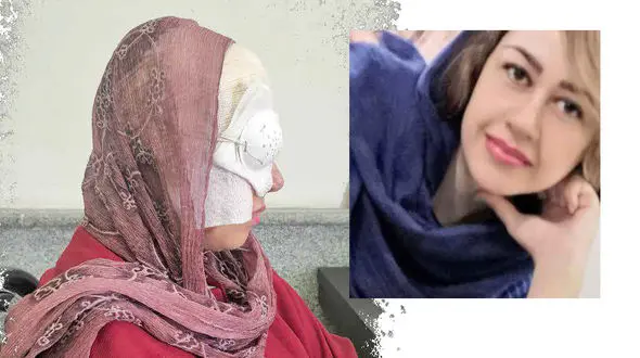 اسیدپاشی عاشق کینه جو به زن جوان و دختر بی گناهش / این گفتگو دلتان را به درد می آورد! + عکس