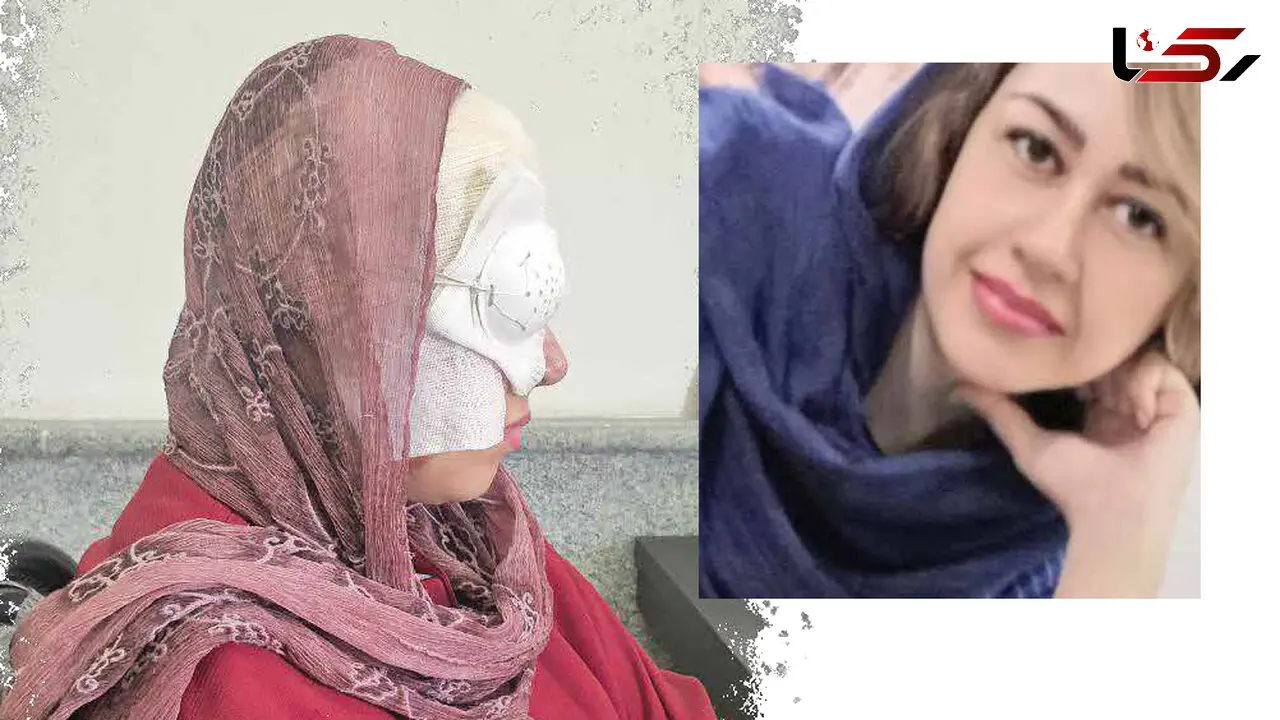 اسیدپاشی عاشق کینه جو به زن جوان و دختر بی گناهش / این گفتگو دلتان را به درد می آورد! + عکس