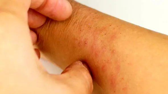 بیماری ایدز و HIV / جدول آخرین دستاوردهای درمانی بیماری ایدز در جهان