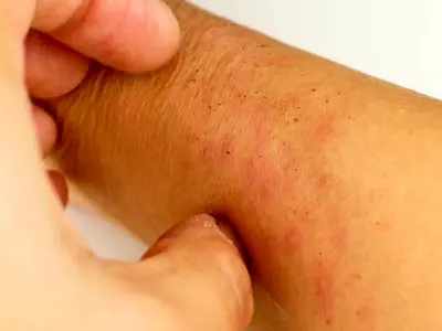 بیماری ایدز و HIV / جدول آخرین دستاوردهای درمانی بیماری ایدز در جهان