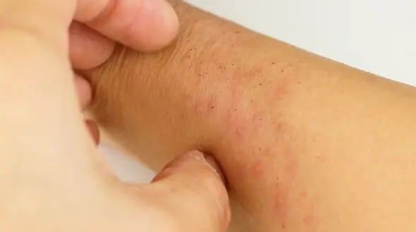 بیماری ایدز و HIV / جدول آخرین دستاوردهای درمانی بیماری ایدز در جهان