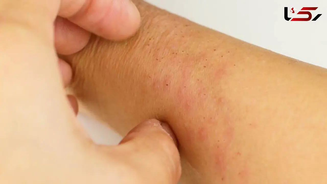 بیماری ایدز و HIV / جدول آخرین دستاوردهای درمانی بیماری ایدز در جهان