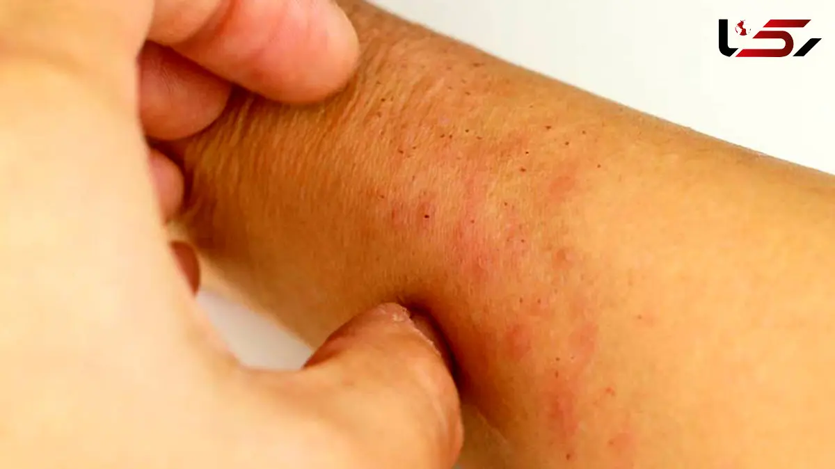 بیماری ایدز و HIV / جدول آخرین دستاوردهای درمانی بیماری ایدز در جهان