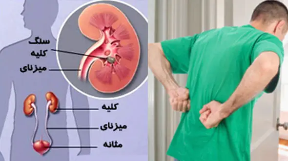 نکاتی درباره بیماری و روزه نگرفتن