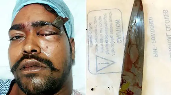 نجات معجزه آسای یک مرد از کوری چشم + عکس16+