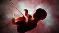 ۳۰ درصد سقط جنین‌های غیرقانونی توسط کارشناسان رشته پزشکی انجام می گیرد