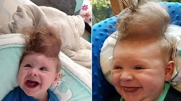 این اتفاق مغزتان را از سر بیرون می‌کشد + تصاویر
