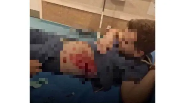 حمله با چاقو به یک پزشک به علت خصومت شخصی/ضارب در کمتر از 1 ساعت دستگیر شد!