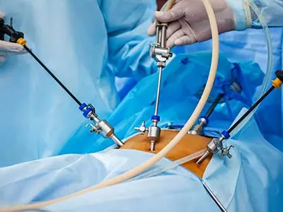 فلوشیپ چیست؟