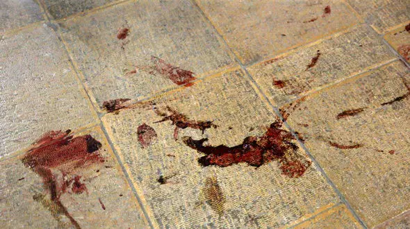 هیچ زنی بین مجروحان حمله تروریستی شاهچراغ نیست + اسامی همه مجروحان