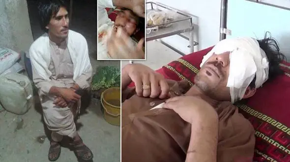 مردی با «قاشق» چشمان پسرش را از حدقه در آورد / این پسر 22 ساله عاشق شده بود! + عکس 14+