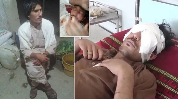 مردی با «قاشق» چشمان پسرش را از حدقه در آورد / این پسر 22 ساله عاشق شده بود! + عکس 14+