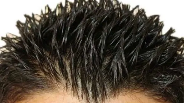 چرا موی سر  زود به زود چرب می شود؟