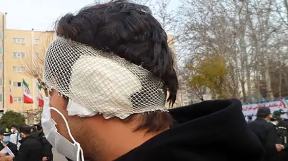 بریدن گوش جوان تهرانی توسط اوباش+ فیلم  و عکس