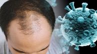 آیا پاستیل های میلیونی باعث درمان ریزش مو بر اثر کرونا می شوند؟ / یک متخصص پوست و مو: باور نکنید! 